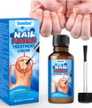 Sumifun - Nail Fungus Treatment Liquid (Original)